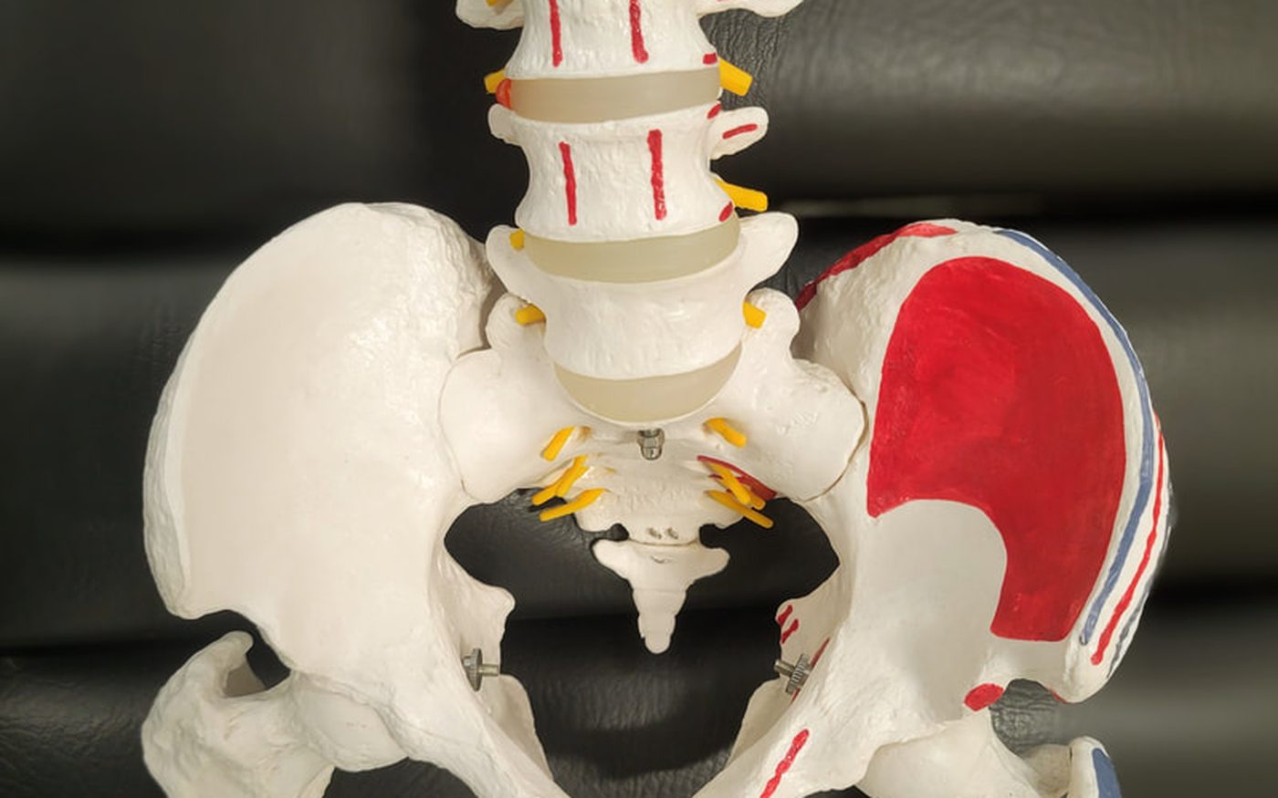 Anatomical spine and pelvis model used in treatment